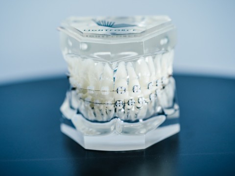 LightForce正畸公司获得5000万美元C轮融资，推进3D打印定制牙套的发展