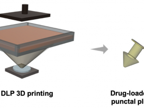 干眼症福音，UCL、USC和Fabrx开发出新型3D打印点滴塞可替代滴眼液