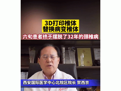 3D打印椎体让男子摆脱30年颈椎病（组图）