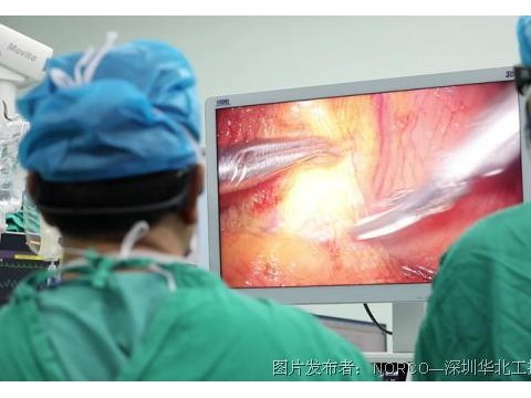 助推医院微创手术发展，华北工控可提供超高清腹腔镜系统专用计算机